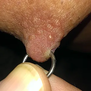 My new piercing gallery image