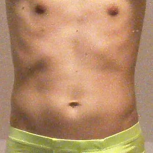 Myself gallery image