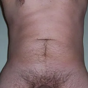 My dick gallery image