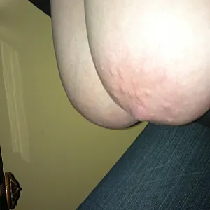 Titts gallery image