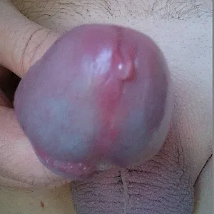 A small mix on both sites gallery image
