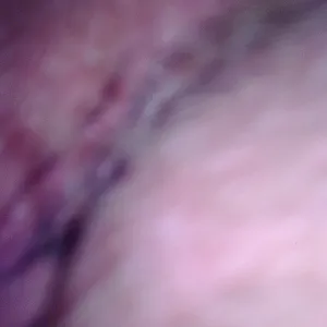 me part 2 gallery image