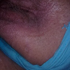 me part 2 gallery image