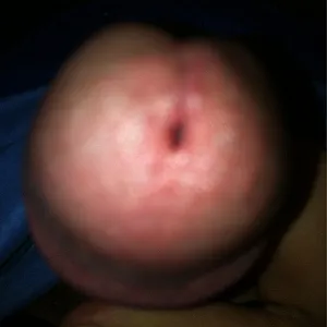 my cock gallery image