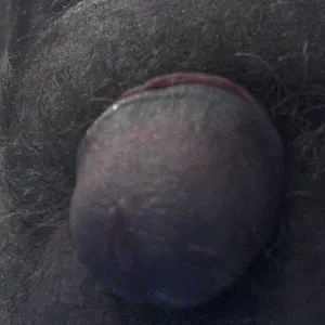 First image of Adonis1962's Gallery - Hygien of a man