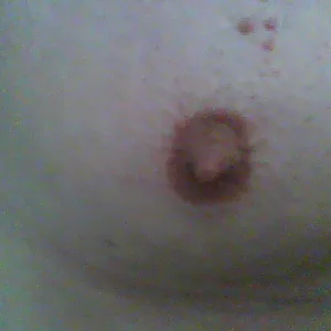 Nipple gallery image