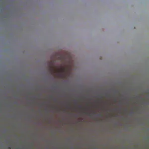 Nipple gallery image