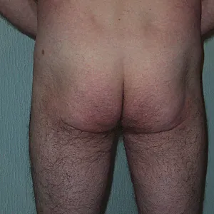 2. Versuch Galeriebild