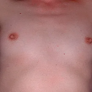My small breast gallery image