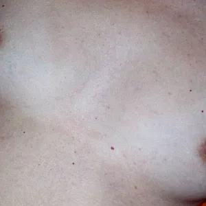 My small breast gallery image