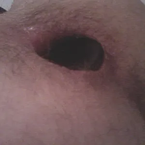 analgames gallery image