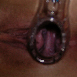 Speculum and hand in my wet pussy gallery image