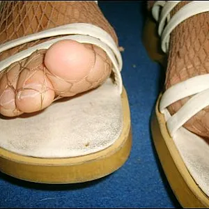 Feet in shoes gallery image