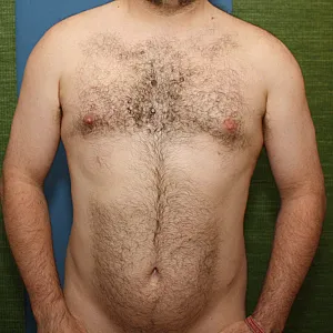 Meine nackt Fotos Galeriebild