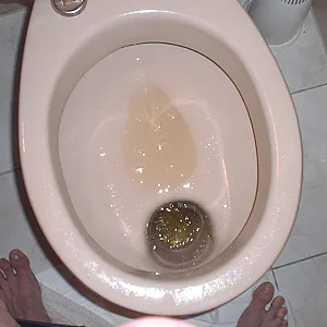 toilett gallery image