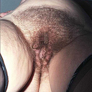 I love it hairy Galeriebild