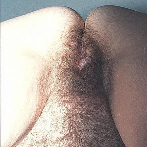 I love it hairy Galeriebild