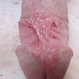 after shaving gallery image