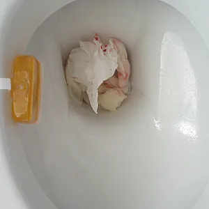 peeing after shaving gallery image