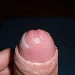 Again gallery image