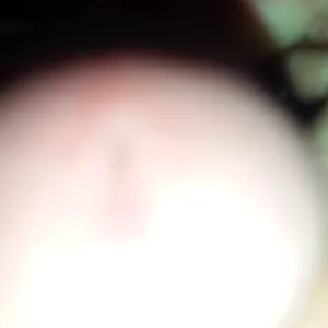 Dick gallery image
