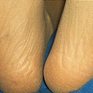 Nylonfeet gallery image