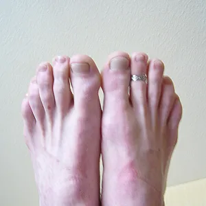 male feets gallery image