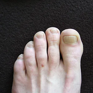 male feets gallery image