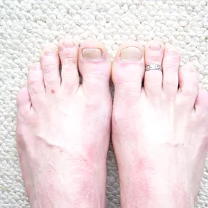 male feets gallery image