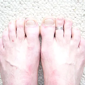 male feets gallery image