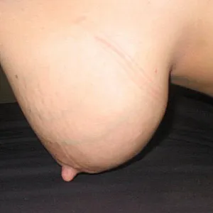 meine Frau nachts mit 2 Promille Galeriebild