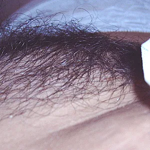 Also gut-noch eine Serie von meiner behaarten Pussy!! Galeriebild