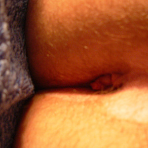 My holes gallery image