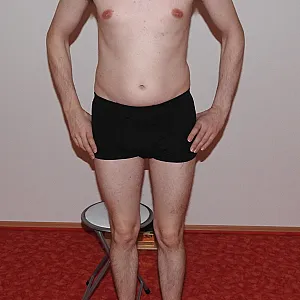 striptease gallery image