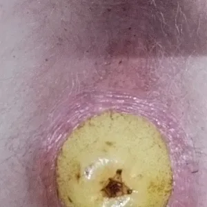 asshole stretching gallery image