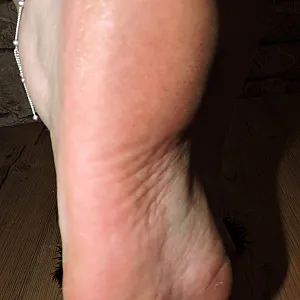 Fotzen Feet und Mules Galeriebild