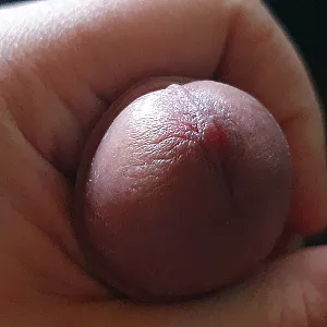 my dick gallery image