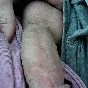 Dickpics Galeriebild