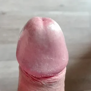 my cock gallery image