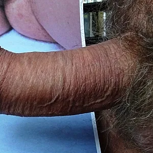 mein behaarter body Galeriebild