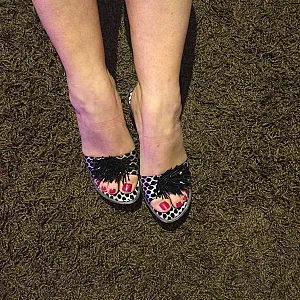 feets gallery image