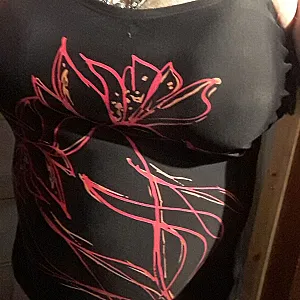 my breast gallery image