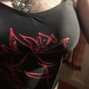my breast gallery image