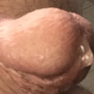 Kleine Übersucht Galeriebild