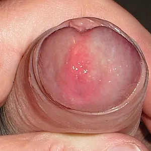 DickPic 2 gallery image