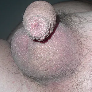 my dick gallery image