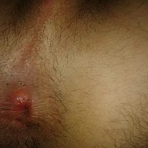 Nicht nur mein Penis ist interessant, der Rest auch Galeriebild