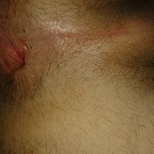 Nicht nur mein Penis ist interessant, der Rest auch Galeriebild
