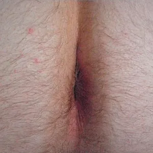 Moi votre petite pute. Galeriebild