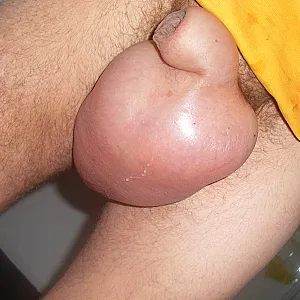 my pics gallery image